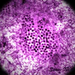 niaid-west-nile-wiki.jpg