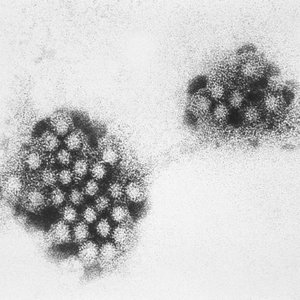 norovirus.jpg