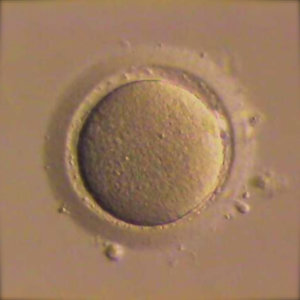 oocyte.jpg
