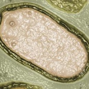 pandoravirus.jpg