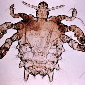 pthius_pubis_-_crab_louse.jpg