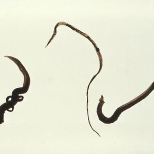 schistosoma_mansoni_trematodes.jpg