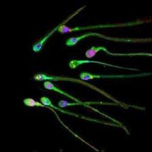 spermes.jpg