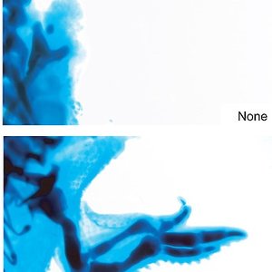thalidomide-recherche.jpg