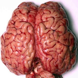 the-human-brain-neuroscience-4966969-562-800.jpg