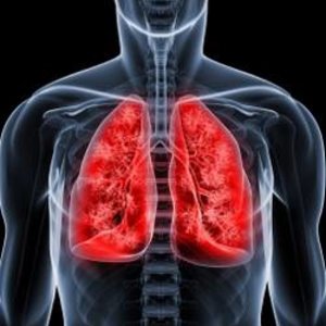 tuberculosepoumons.jpg